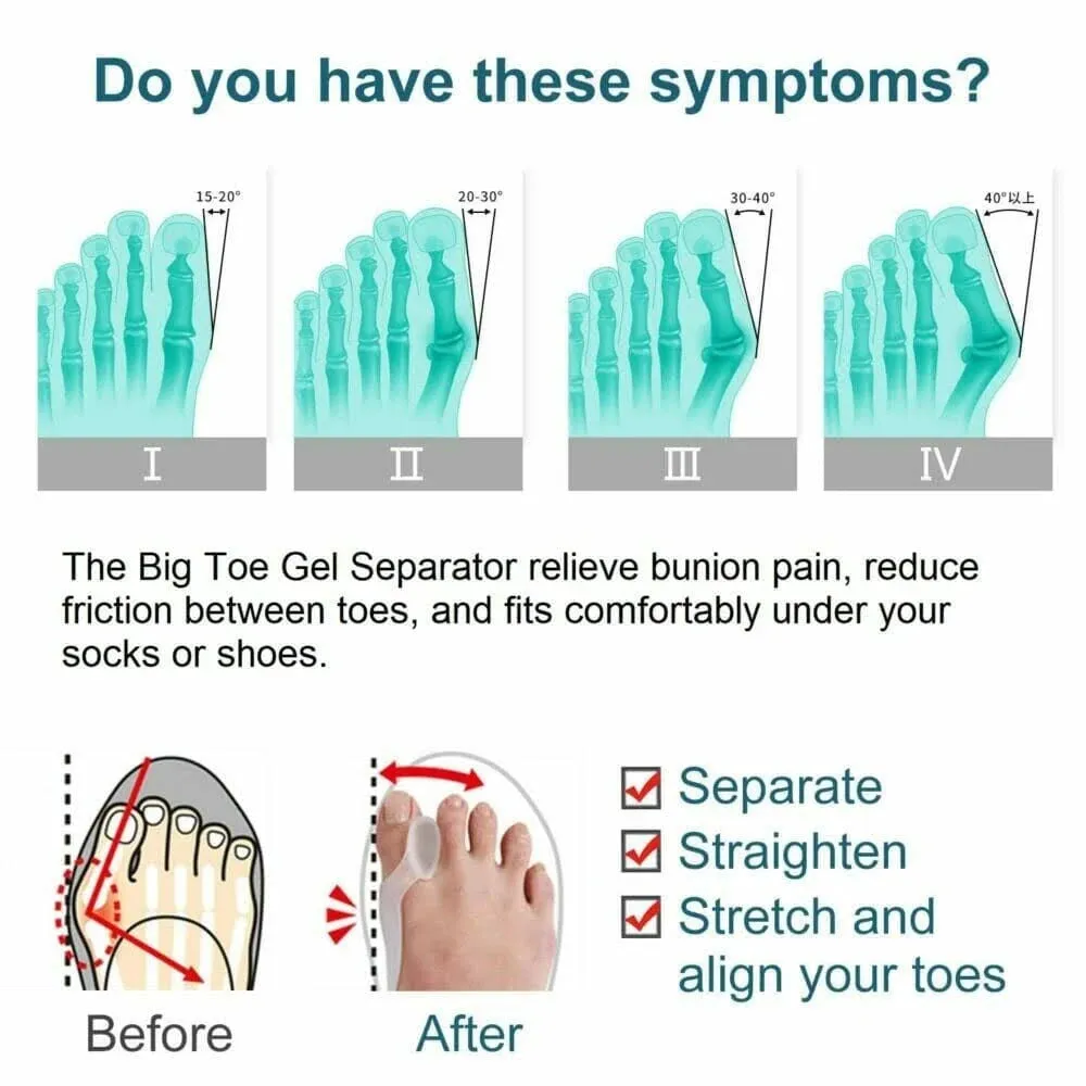 Gel Dual Action Bunion Fix