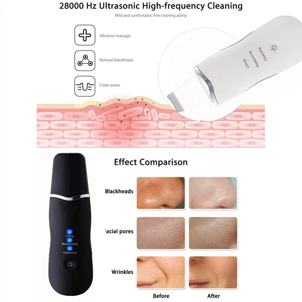 Ultrasonic Face Cleaning Machine Skin Scrubber Deep Cleaning Machine SPA Spatula Skin Scrubber Remove Blackhead Acne Tool FoLLoo